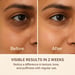 SKOG Under Eye Repair Oil | Eye Recovery With Potato Oil & Vitamin E – Reduces Dark Circles & Puffiness | 10Ml