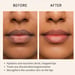 SKOG Lip Repair Oil: Nourishing & Hydrating Lip Treatment (10Ml)